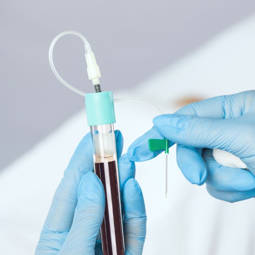 PRP-Gesichtsbehandlung (Vampire Lifting) in der Privatpraxis Dr. Ruhnau